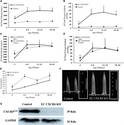 Role of endothelial CXCR4 in the development of aortic valve stenosis